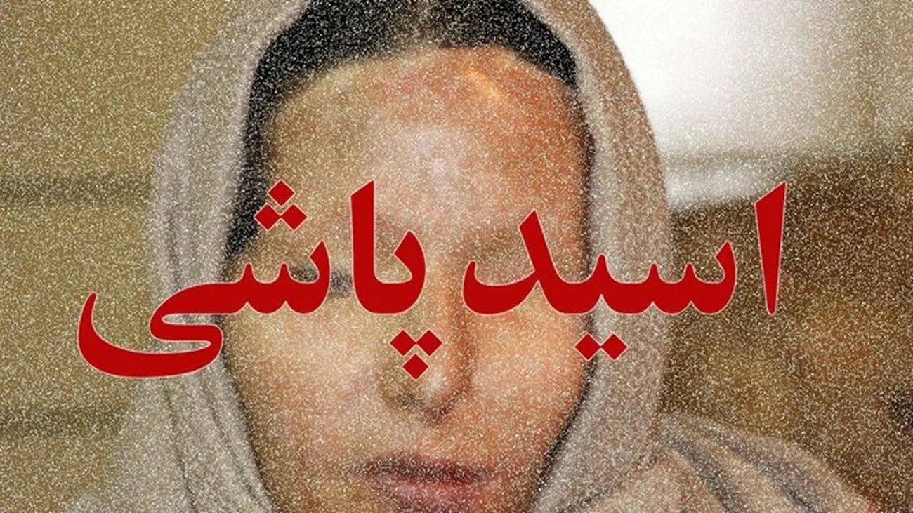 پشت پرده اسیدپاشی به یک زن در تهران
