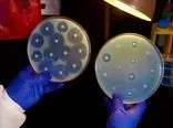 ردیابی گسترش جهانی مقاومت باکتری‌ها در برابر آنتی‌بیوتیک