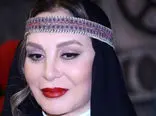 عکس 9 خانم بازیگر ایرانی که تزریق ژل کردند + اسامی باورنکردنی