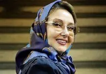 عکس شوکه کننده از کتایون ریاحی بعد از جدیدترین عمل زیبایی / 30 سال جوانتر شد !