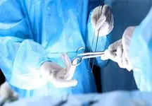 جراحی شگفت‌انگیز در کرج: عکس خارج کردن ۴۷ پیچ تیز از معده بیمار