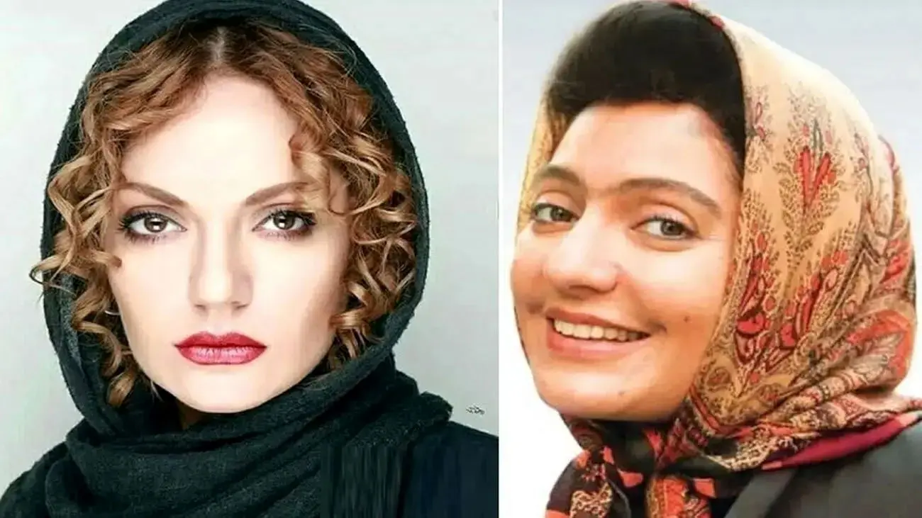تغییر چهره عروسکی مهناز افشار بعد از مهاجرت / خانم بازیگر زیباتر از همیشه !