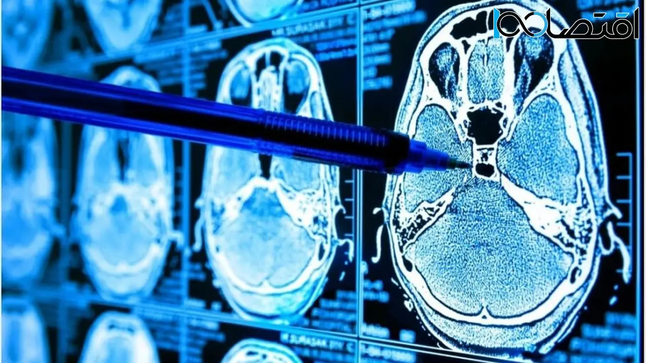 توسعه هوش مصنوعی جدیدی که می‌تواند نشانه‌های بیماری را در اسکن‌های MRI پیدا کند
