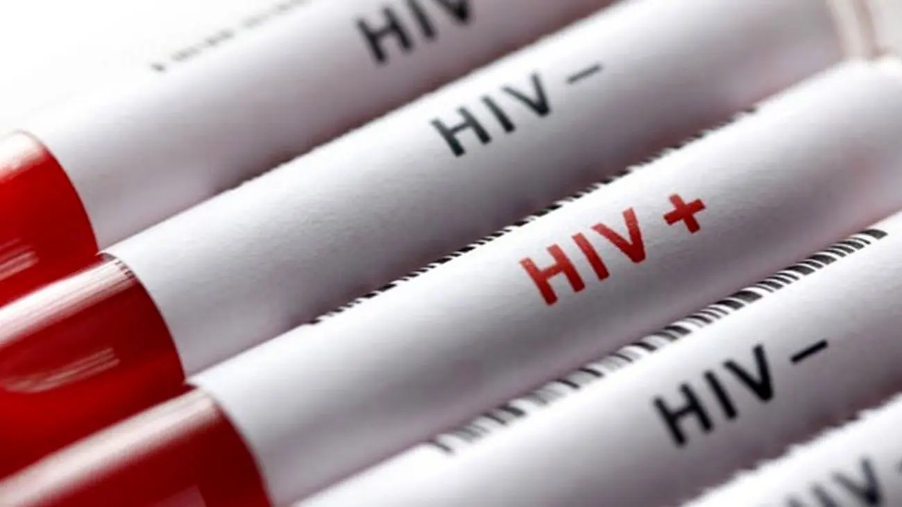 ۵۵ هزار نفر مبتلا به اچ. آی. وی در ایران / سهم دو رقمی زنان در ابتلا به ایدز