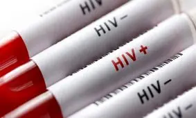 5 هزار نفر مبتلا به HIV طی دو سال در ایران چه شدند؟