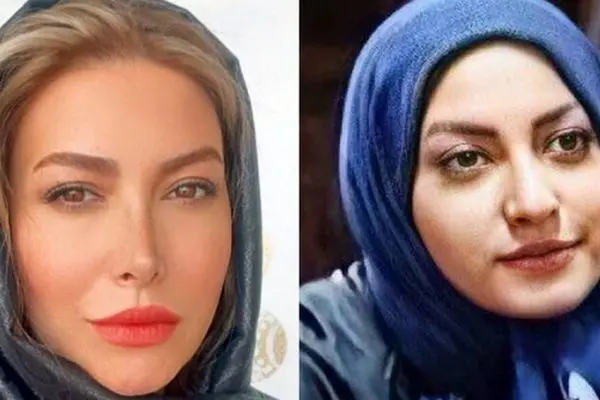 فیلم افشاگری بزرگ فریبا نادری / بینی جدیدم مسیر زندگی‌ام را عوض کرد!