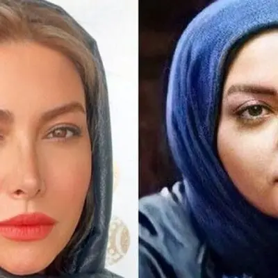 فیلم افشاگری بزرگ فریبا نادری / بینی جدیدم مسیر زندگی‌ام را عوض کرد!
