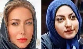 فیلم افشاگری بزرگ فریبا نادری / بینی جدیدم مسیر زندگی‌ام را عوض کرد!