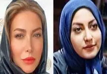 فیلم افشاگری بزرگ فریبا نادری / بینی جدیدم مسیر زندگی‌ام را عوض کرد!