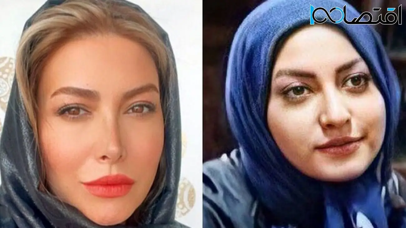 فیلم افشاگری بزرگ فریبا نادری / بینی جدیدم مسیر زندگیام را عوض کرد!