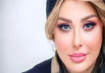 عکس لو رفته از لحظه زایمان نیوشا ضیغمی در اتاق عمل / سانسوری و خجالت آور !