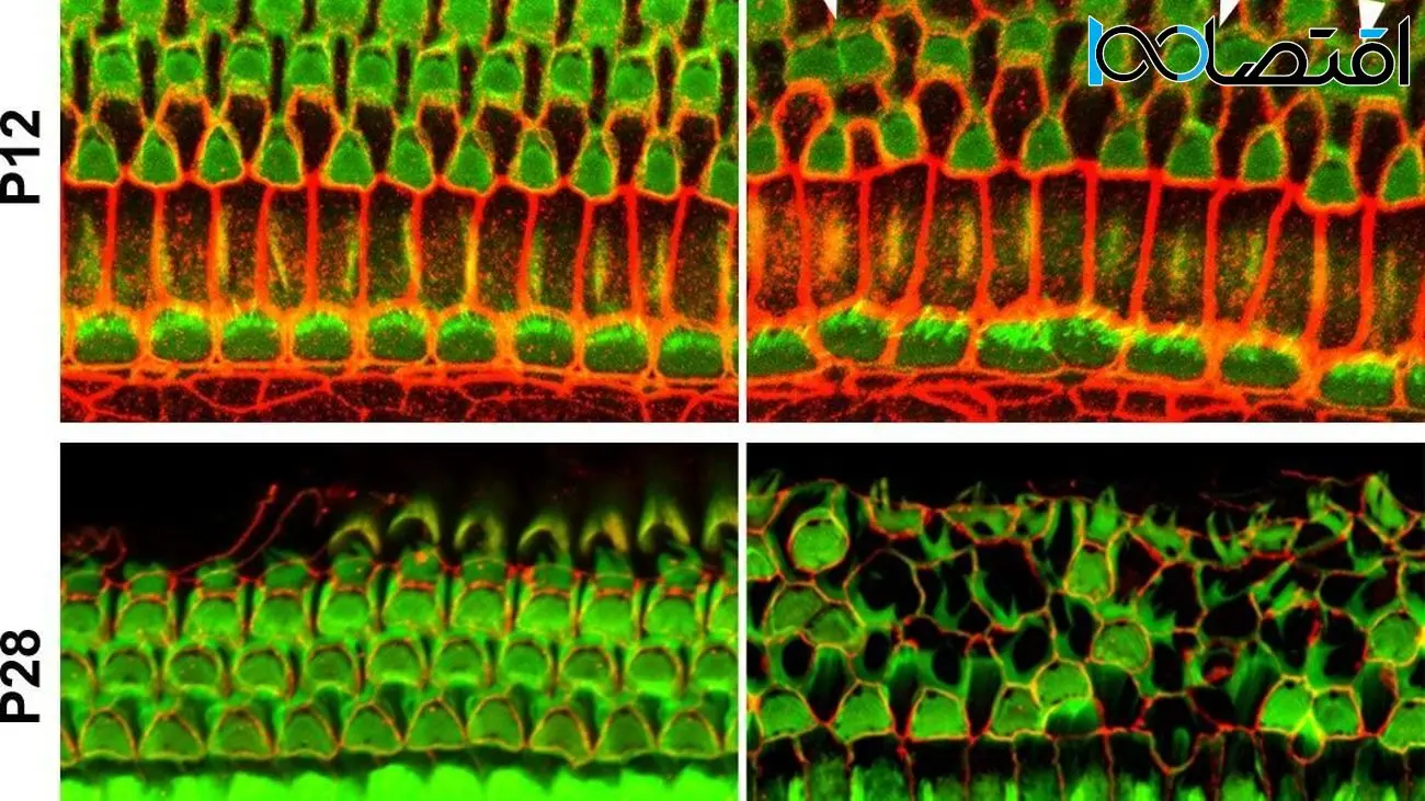 کشف الگوی شطرنجی سلول‌های گوش داخلی که برای شنیدن حیاتی است