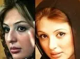 عکس قبل و بعد 7 خانم بازیگر ایرانی بعد از عمل های عروسکی / چه بودند و چه شدند !