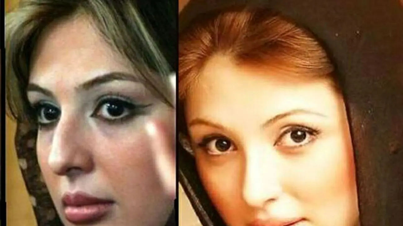 عکس قبل و بعد 7 خانم بازیگر ایرانی بعد از عمل های عروسکی / چه بودند و چه شدند !