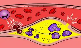 کشف پروتئینی که منجر به بیماری قلبی می‌شود