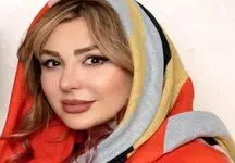 چهره باورنکردنی نیوشا ضیغمی قبل از عمل بینی / چی بود چی شد !