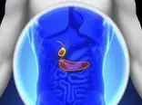 تولید شبه اندام‌های پانکراسی ترشح‌کننده انسولین/ابداع روش‌هایی برای زندگی بهتر افراد دیابتی