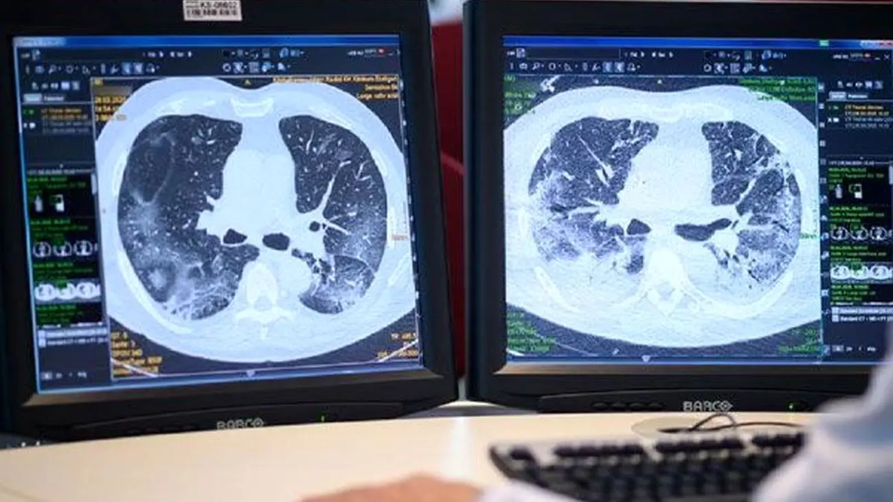 روش جدید تصویربرداری مسیر درست را در طول جراحی سرطان ریه مشخص می‌کند