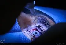پشت پرده خیانت ساکت برخی چشم‌پزشکان به مردم / عمل خاص برای پول