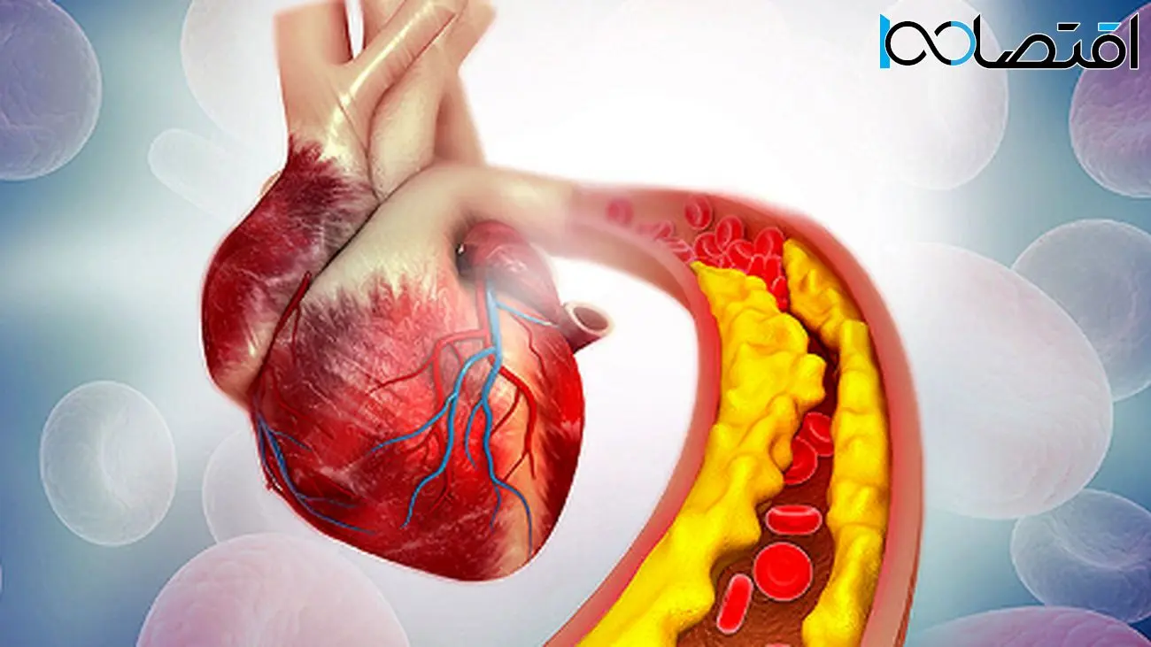 معجزه کاهش کلسترول خون با یک دانهی خوراکی شگفتانگیز