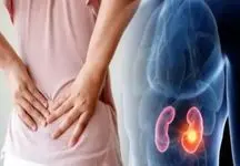 این بیماری علائمی ندارد / روش دقیق شناسایی با سونوگرافی را بشناسید