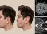 بیماری نادری که باعث می‌شود چهره افراد را شبیه به فیلترهای «تیک‌تاک» ببینید