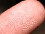 محققان: عرق نوک انگشت می‌تواند شیوه مصرف دارو توسط بیماران را نشان دهد
